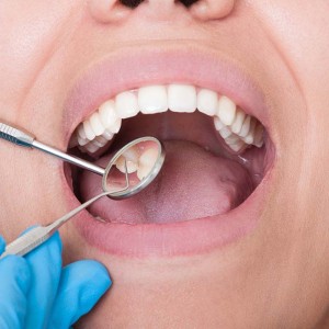 Hill City Dental Comprehensive Dental Exam